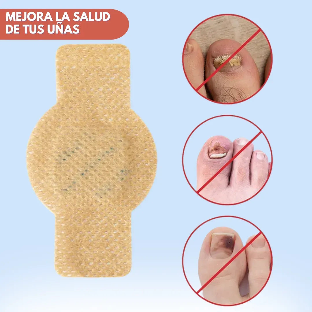 DermaPatch™ - Parches Antifúngicos para Hongo