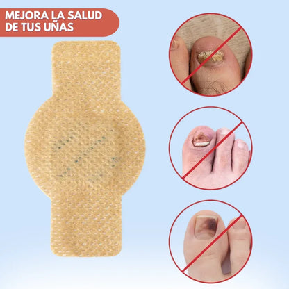 DermaPatch™ - Parches Antifúngicos para Hongo