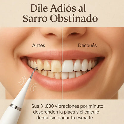 SarroClean Pro™- Limpiador Dental Recargable + Kit Completo🎁